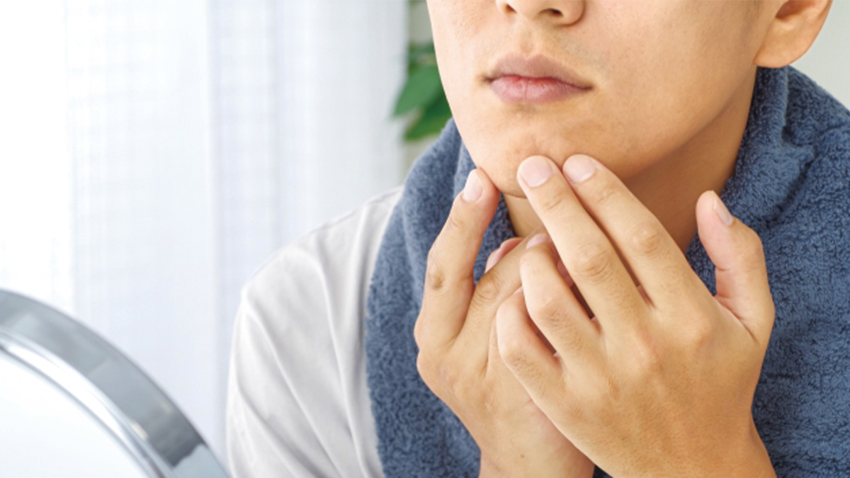 ヒゲ脱毛ガイド（医療 vs サロン）